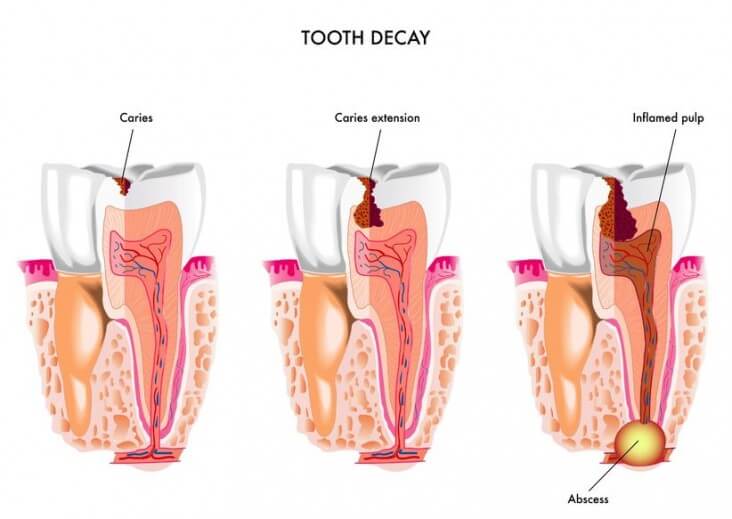 When To Go To Emergency Dentist